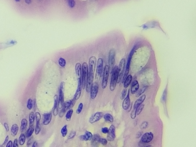 Simple Columnar Epithelium Slides - Simple Columnar Epithelium 10 400X